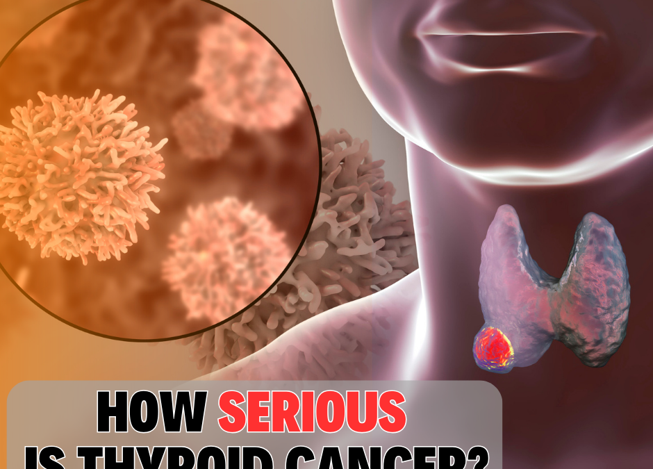 Understanding the Severity of Thyroid Cancer